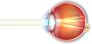 cornea-occhio-astigmatismo