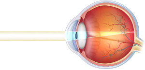 cornea-occhio-normale